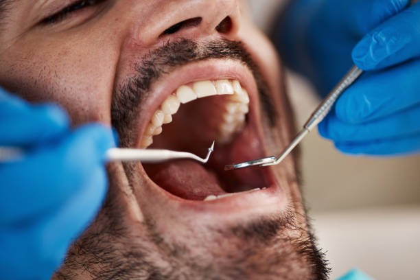 Best Emergency Dental Care for Trauma or Injury in Lone Tree, IA